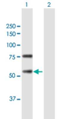 Western Blot: REC8 Antibody [H00009985-B01P]