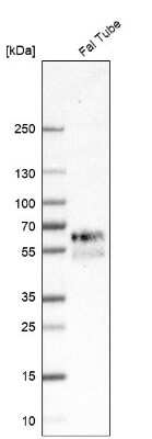 Western Blot: REC8 Antibody [NBP1-87144]