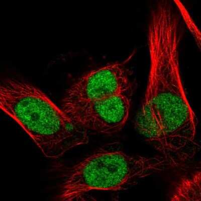 Immunocytochemistry/ Immunofluorescence: RECQ1 Antibody [NBP2-57572]