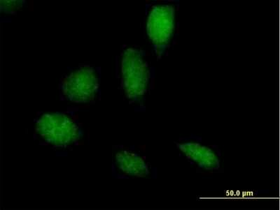 Immunocytochemistry/ Immunofluorescence: RECQL5 Antibody [H00009400-B01P]