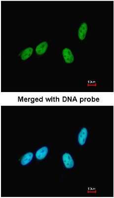 Immunocytochemistry/ Immunofluorescence: RED Antibody [NBP1-30927]