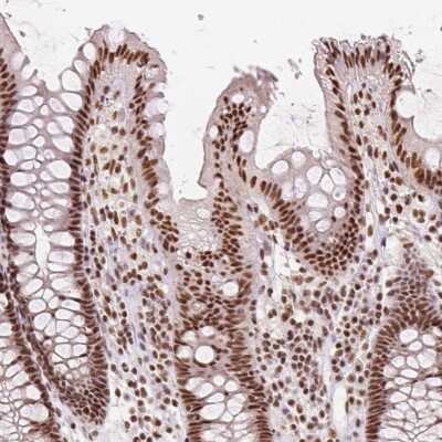 Immunohistochemistry: RED Antibody [NBP2-38591]