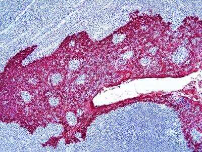 Immunohistochemistry-Paraffin: RED HRP Staining Kit (Colorimetric) [NBP3-12179]