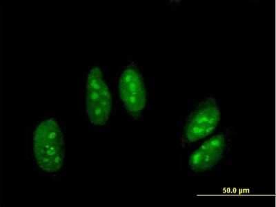 Immunocytochemistry/ Immunofluorescence: RED1 Antibody [H00000104-B01P]