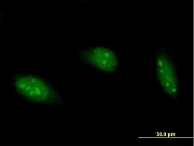 Immunocytochemistry/ Immunofluorescence: RED1 Antibody [H00000104-B02P]