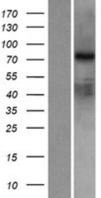 Western Blot: RED2 Overexpression Lysate [NBP2-06764]