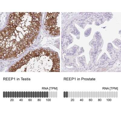 Immunohistochemistry-Paraffin: REEP1 Antibody [NBP2-34095]