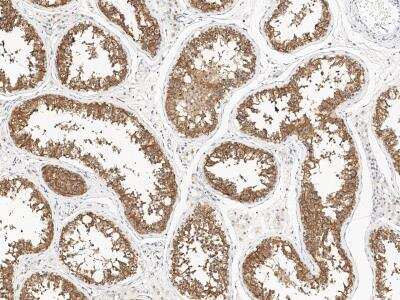Immunohistochemistry-Paraffin: REEP1 Antibody [NBP3-14647]