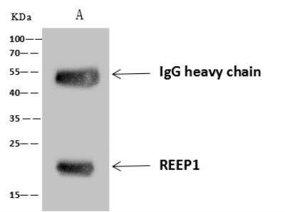 Immunoprecipitation: REEP1 Antibody [NBP3-14647]