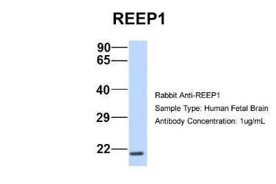 Western Blot: REEP1 Antibody [NBP1-69643]