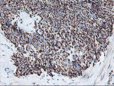 Immunohistochemistry-Paraffin: REEP2 Antibody (OTI2C7) [NBP2-01796]