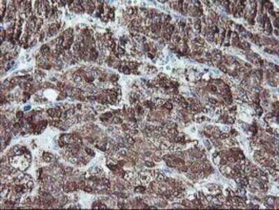 Immunohistochemistry: REEP2 Antibody (OTI2C7) - Azide and BSA Free [NBP2-73849]
