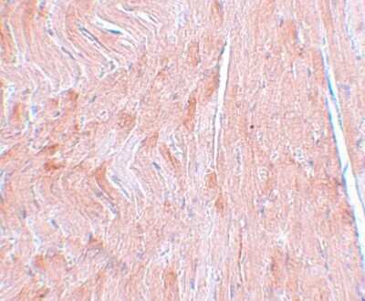 Immunohistochemistry-Paraffin: REEP3 Antibody - BSA Free [NBP1-77105]