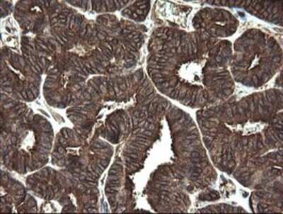 Immunohistochemistry: REEP5 Antibody (OTI4D2) [NBP2-45945]