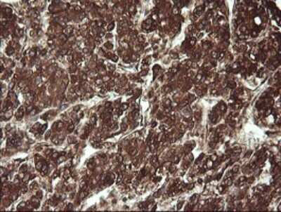 Immunohistochemistry: REEP5 Antibody (OTI4D2) [NBP2-45945]
