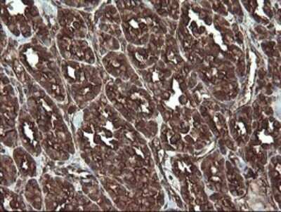 Immunohistochemistry: REEP5 Antibody (OTI4D2) [NBP2-45945]