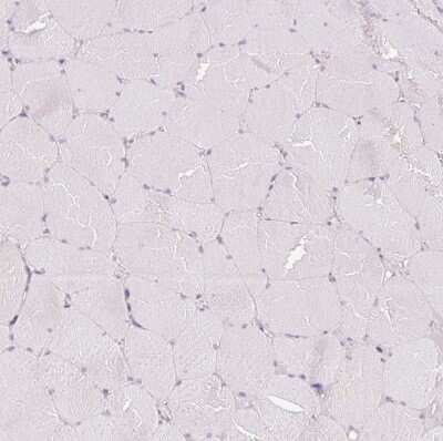 Immunohistochemistry-Paraffin: REEP6 Antibody [NBP2-37919]