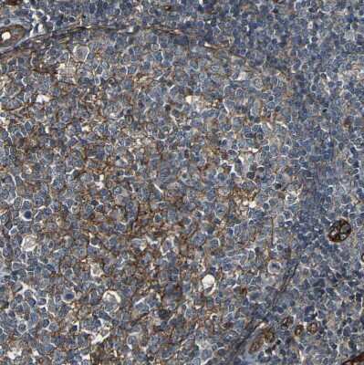 Immunohistochemistry-Paraffin: RELL1 Antibody [NBP1-90886]
