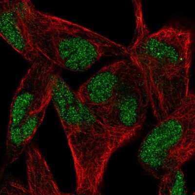 Immunocytochemistry/ Immunofluorescence: RELT/TNFRSF19L Antibody [NBP2-56851]