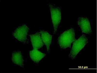 Immunocytochemistry/ Immunofluorescence: REM1 Antibody [H00028954-B01P]