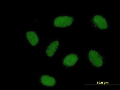 Immunocytochemistry/ Immunofluorescence: REM2 Antibody [H00161253-B01P]