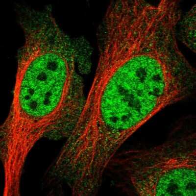 Immunocytochemistry/ Immunofluorescence: RENT1/UPF1/hUPF1 Antibody [NBP1-89641]