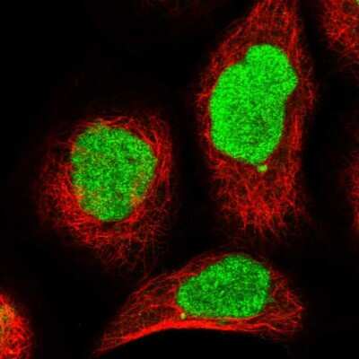 Immunocytochemistry/ Immunofluorescence: REPIN1 Antibody [NBP1-89059]