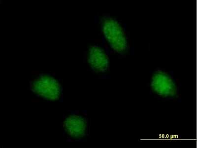 Immunocytochemistry/ Immunofluorescence: REPS1 Antibody [H00085021-B01P]