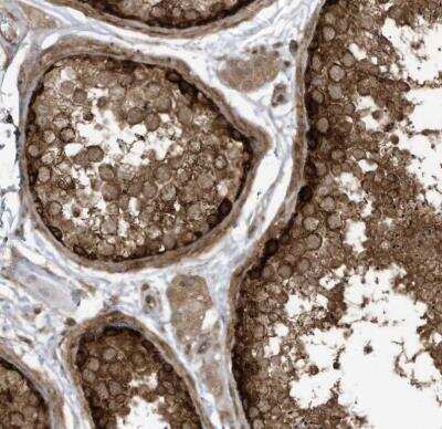 Immunohistochemistry-Paraffin: REPS1 Antibody [NBP1-86344]