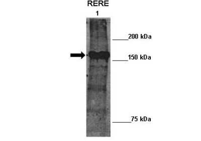 Western Blot: RERE Antibody [NBP2-85626]