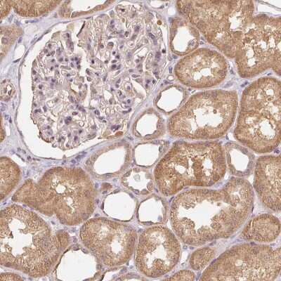 Immunohistochemistry: REV3L Antibody [NBP2-39036]