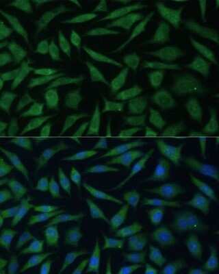 Immunocytochemistry/ Immunofluorescence: REXO2 Antibody - Azide and BSA Free [NBP2-93904]