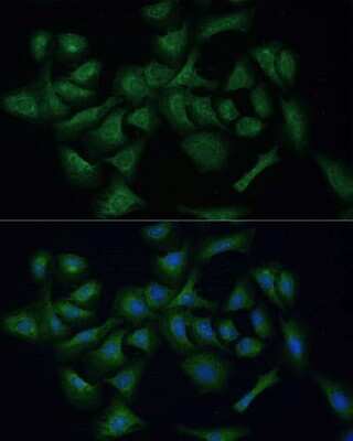 Immunocytochemistry/ Immunofluorescence: REXO2 Antibody - Azide and BSA Free [NBP2-93904]