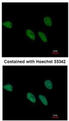 Immunocytochemistry/ Immunofluorescence: REXO4 Antibody [NBP1-31119]