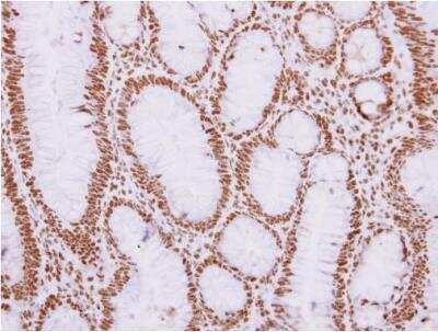 Immunohistochemistry-Paraffin: REXO4 Antibody [NBP1-31119]