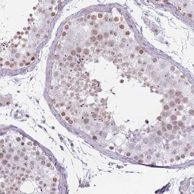 Immunohistochemistry-Paraffin: REXO4 Antibody [NBP2-13221]