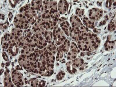 Immunohistochemistry: RFC2 Antibody (OTI2B2) [NBP2-45570]