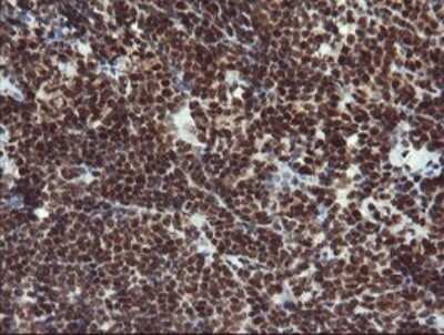 Immunohistochemistry: RFC2 Antibody (OTI2B2) [NBP2-45570]