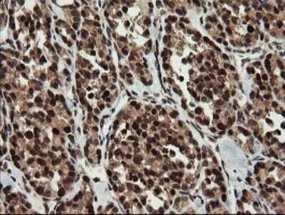 Immunohistochemistry: RFC2 Antibody (OTI2B2) [NBP2-45570]