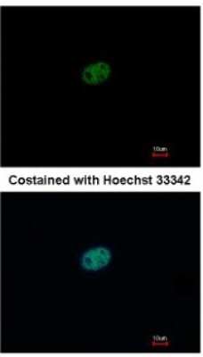 Immunocytochemistry/ Immunofluorescence: RFC2 Antibody [NBP1-32253]