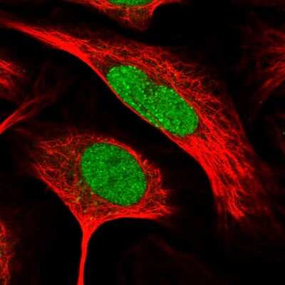 Immunocytochemistry/ Immunofluorescence: RFC2 Antibody [NBP1-89341]