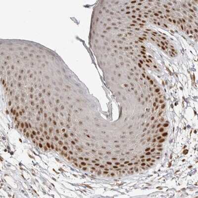 Immunohistochemistry-Paraffin: RFC2 Antibody [NBP1-89341]