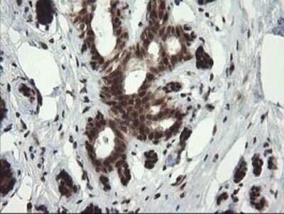 Immunohistochemistry: RFC2 Antibody (OTI2B2) - Azide and BSA Free [NBP2-73857]