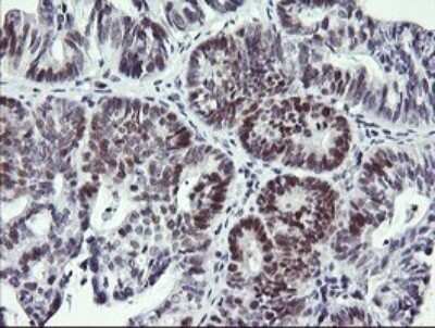 Immunohistochemistry: RFC4 Antibody (OTI1A8) - Azide and BSA Free [NBP2-73859]