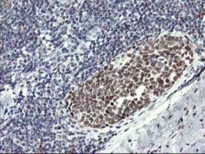 Immunohistochemistry: RFC4 Antibody (OTI1A8) [NBP2-45946]