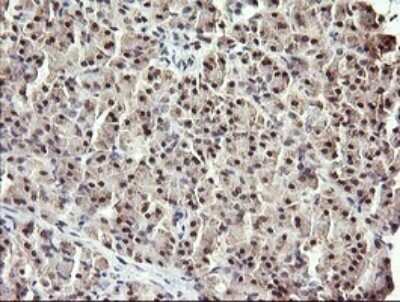 Immunohistochemistry: RFC4 Antibody (OTI1A8) [NBP2-45946]