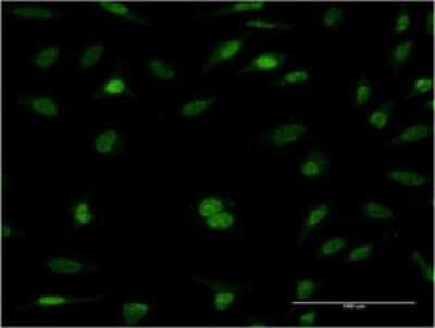 Immunocytochemistry/ Immunofluorescence: RFC5 Antibody (1B1) [H00005985-M01]