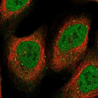 Immunocytochemistry/ Immunofluorescence: RFC5 Antibody [NBP1-87137]