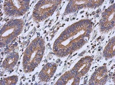 Immunohistochemistry-Paraffin: RFESD Antibody [NBP2-20136]
