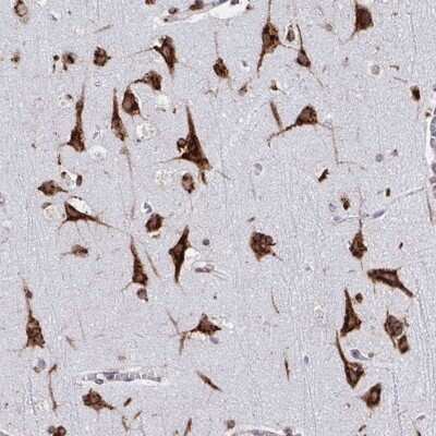 Immunohistochemistry-Paraffin: RFK Antibody [NBP2-37962]
